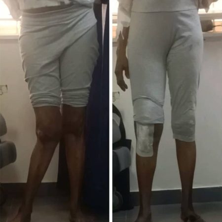 AFFORDABILITY       We are pioneering cost-effective orthopedic solutions to make high-quality care accessible globally.